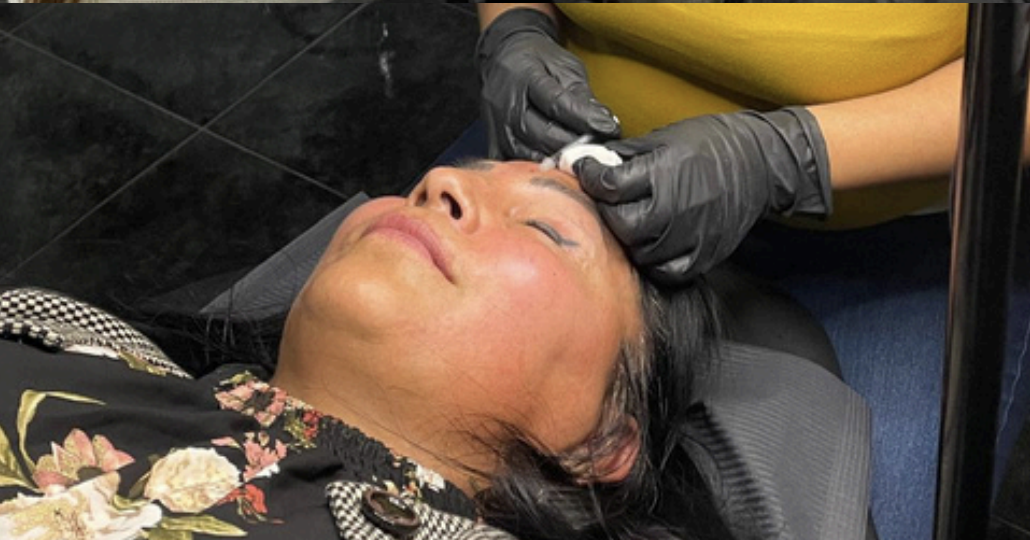 Tratamiento facial